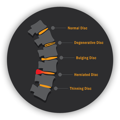 b1-back-pain-spine-graphic.png b1-back-pain-spine-graphic.png